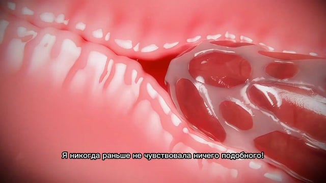 Miki3DX Medical Fetish With Clit Growth And Squirting